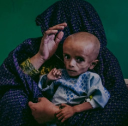 د لوږې ضد اقدام: په افغانستان کې خوارځواکي بې‌ ساري کچې ته لوړه شوې